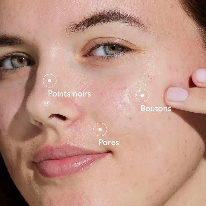 Caudalie – Vinopure - Sérum à l’Acide Salicylique Anti-Imperfections 30mL